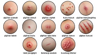 Download lagu Semua Jenis Gigitan Serangga Dijelaskan dalam 9 Menit! mp3