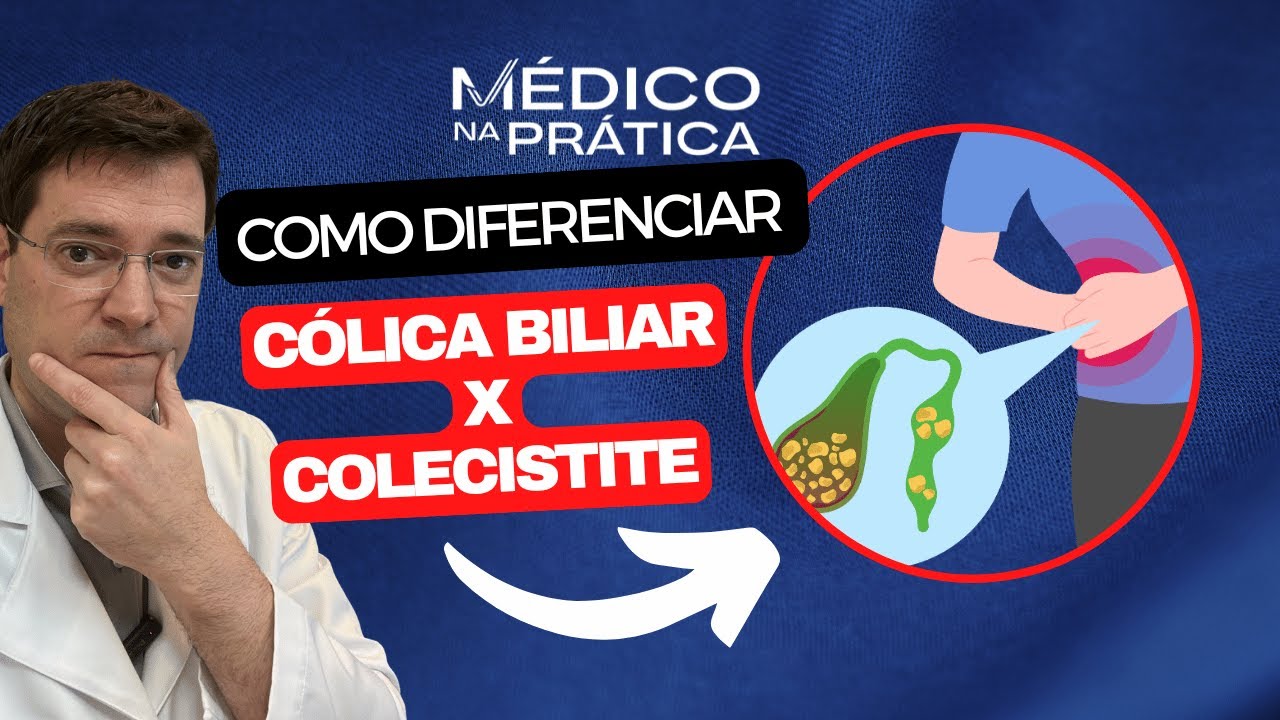 Como diferenciar Cólica Biliar X Colecistite