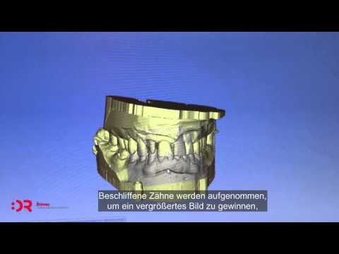 Labor | Dental laboratory | Zubotehnički laboratorij | Zagreb | Štimac centar dentalne medicine | Zubotehnički laboratorij Stomatološka poliklinika Zagreb | Štimac centar dentalne medicine