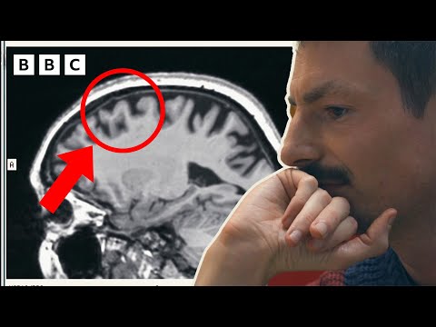 Son's sees how Alzheimer's affected his mum's brain across the years | The Jennings vs Alzheimer's