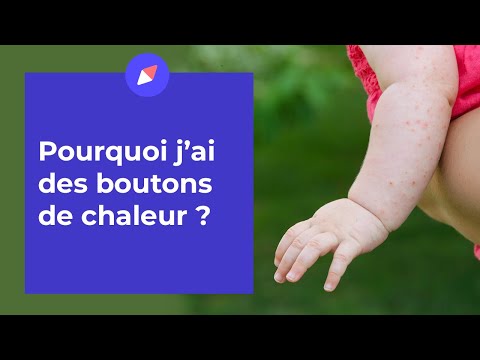 Que Faire Contre les Boutons de Chaleur Chez l’Adulte ?