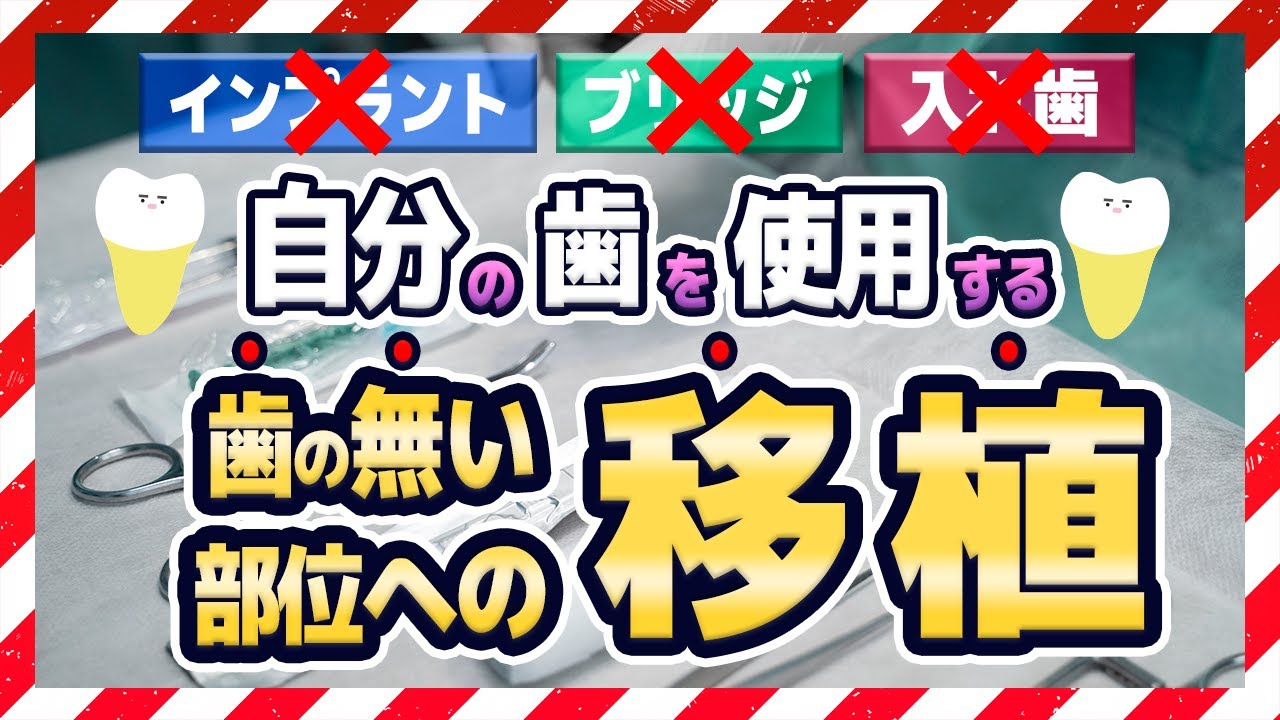 歯の移植?入れ歯やインプラント以外に噛む機能を取り戻す治療