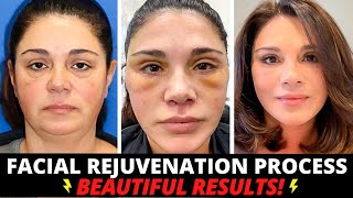 Carmel Valley Plastic Surgery