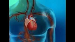 Diabetes and Its Effect on the Heart and Blood Vessels