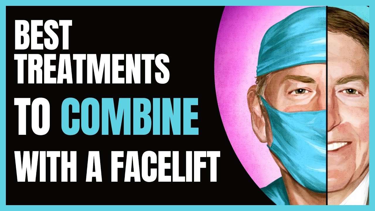 Facelift Series #5: Facelift Friends