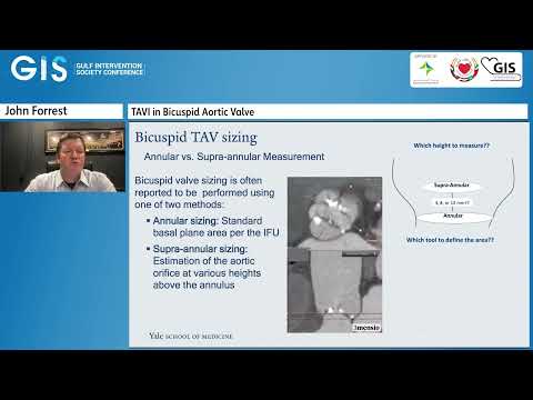 22  John Forrest   TAVI in Bicuspid Aortic Valve