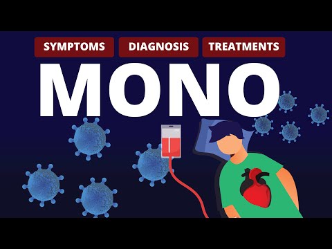 What is MONO?  Symptoms, Diagnosis & Treatments
