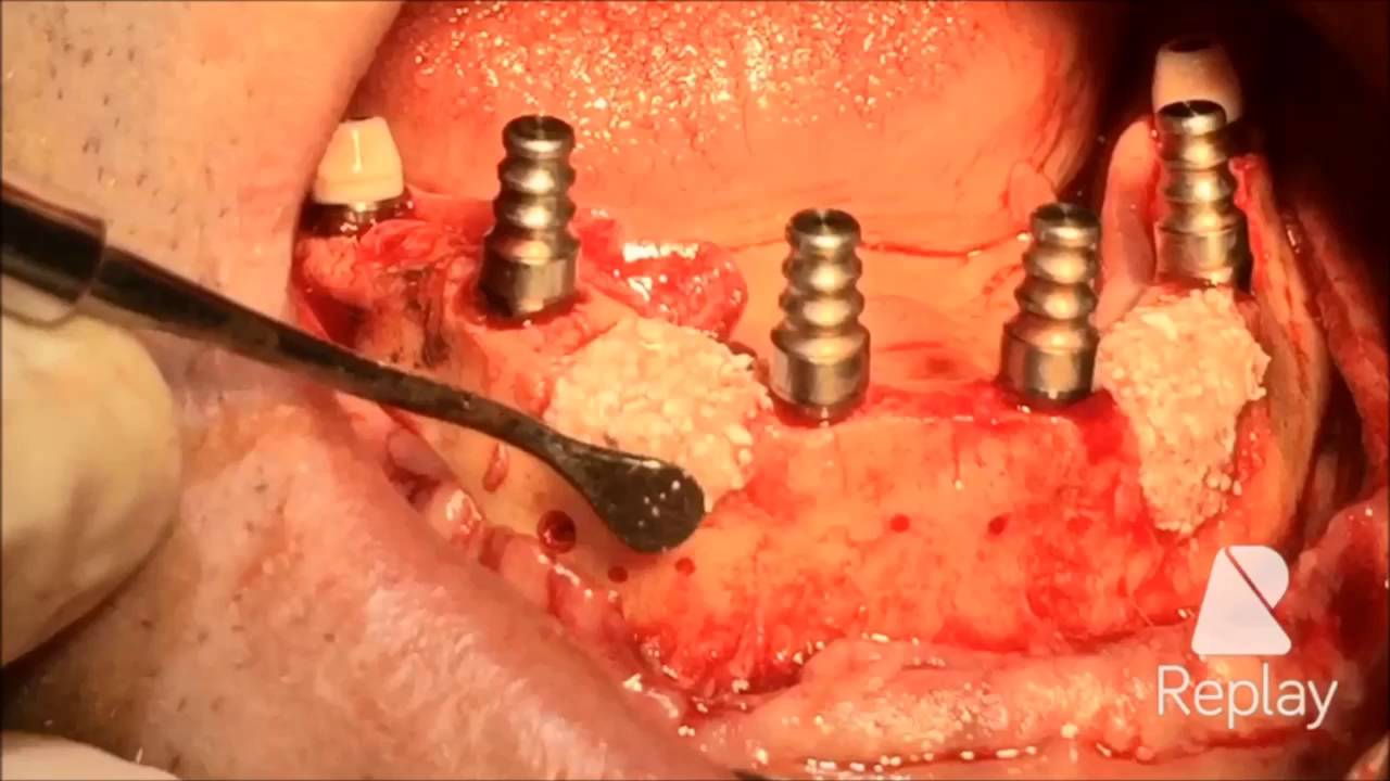 Tolga Gülçiçek-46