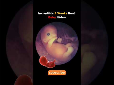 9 Weeks Baby Real Video From Womb 😍Incredible #pregnancy #fetus