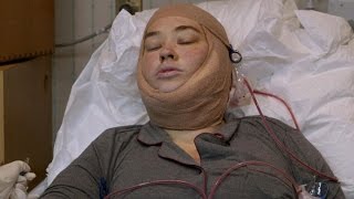 Mama June After Surgery: See the Final Stage of Her 'From Not to Hot' Transformation Mama June After Surgery: See the Final Stage of Her 'From Not to Hot' Transformation
