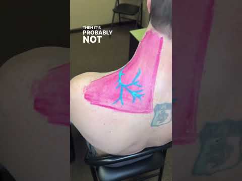 How do you get rid of knots in your neck?