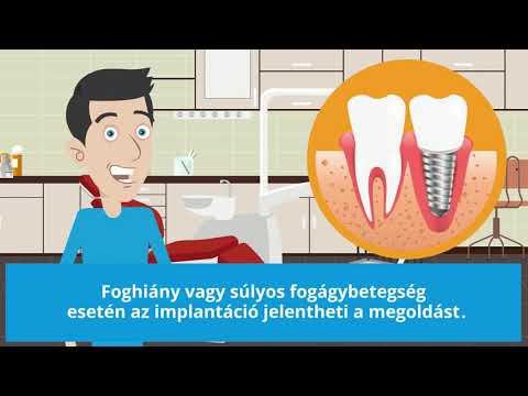 szemész konzultáció elkápráztatja látásromlással, fejfájással