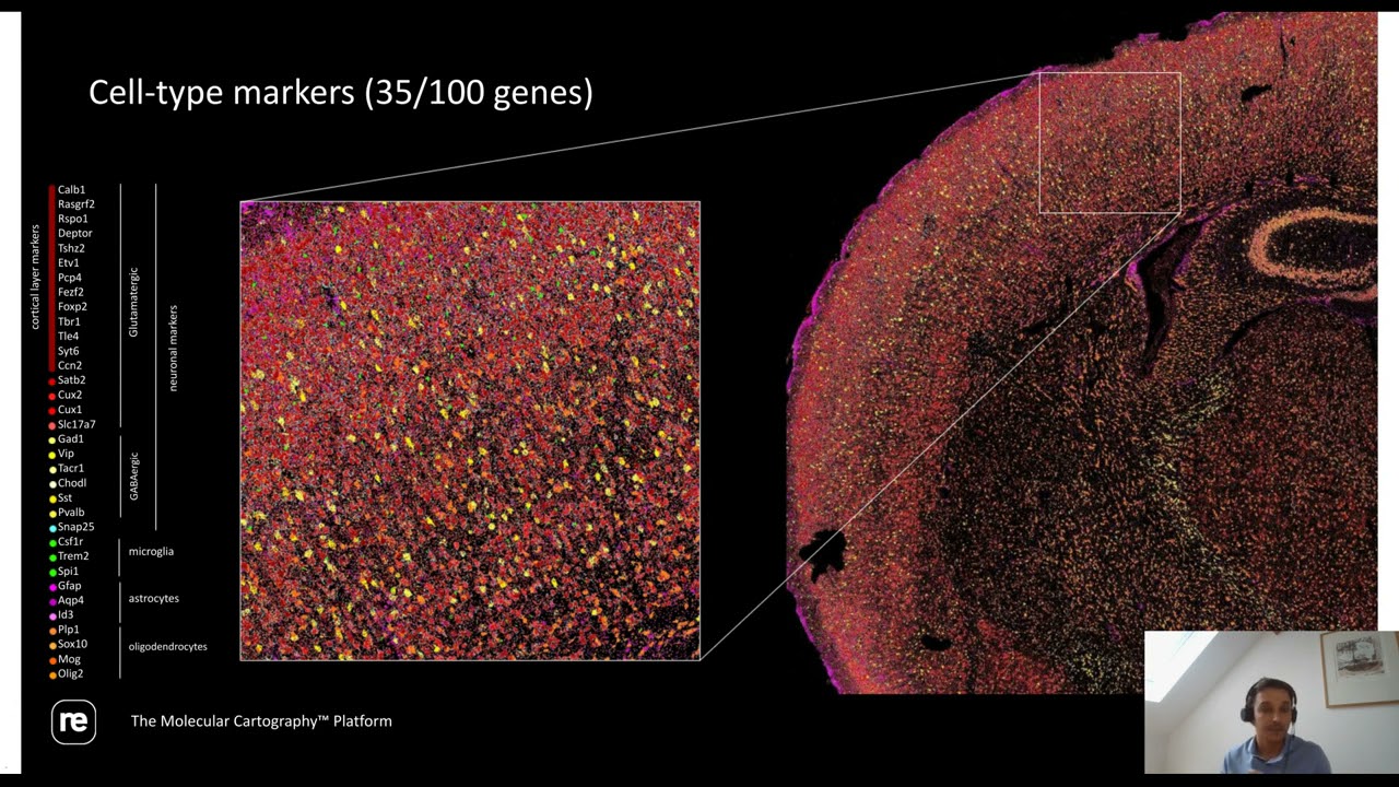 Spatial Context Matters: Molecular Cartography™ to Study Gene Expression Changes in the Brain