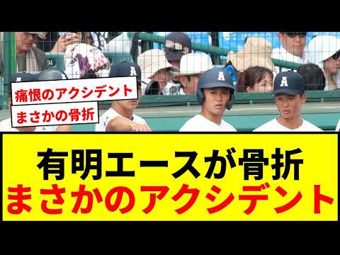 【速報】有明・工修哉投手が「左手甲骨折」で先発回避!まさかのアクシデントにファン衝撃