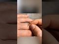 The Pinch Test That Could SAVE Your Life! 🤯