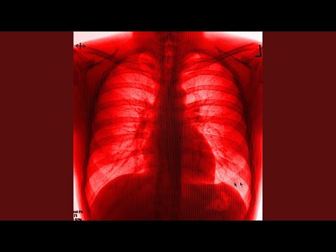 MM MMM (feat. agonyTrey.)