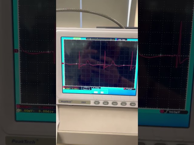 Vídeo relacionado con Britzgo Una nueva experiencia Tecnología de procesamiento de señales digitales Dispositivo recargable (azul)