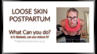 Loose Skin Postpartum, Can we reduce it?