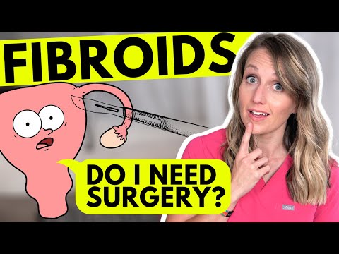 Gynecologist Explains: Fibroid Uterus