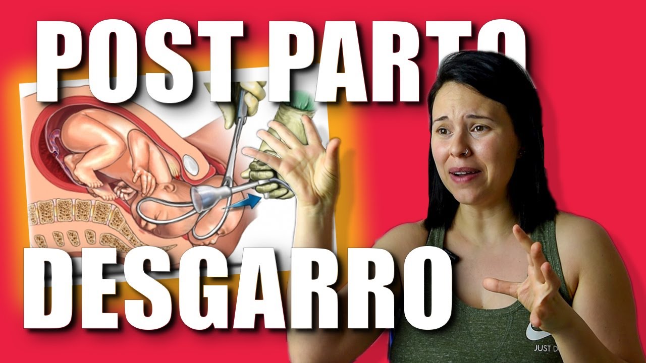 Mi post parto: Desgarro, prolapso de vejiga, puntos y me lo hago encima...