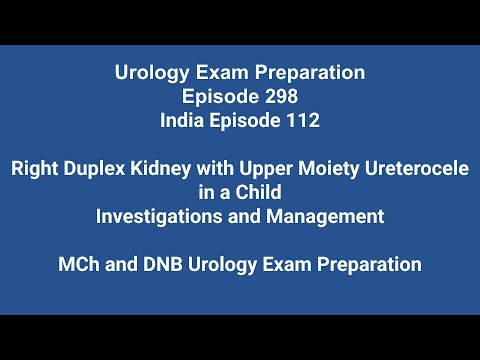 298 Right Duplex Kidney with Upper Moiety Ureterocele in a Child; Investigations and Management