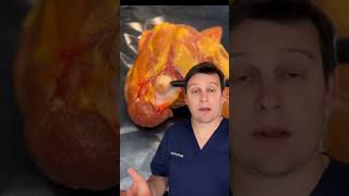 #ARTROSIS Eso qué es?? #explicaciones sencillas y rápidas