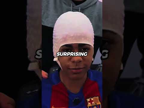 The real reason Lamine Yamal always hides his forehead. 😳😞