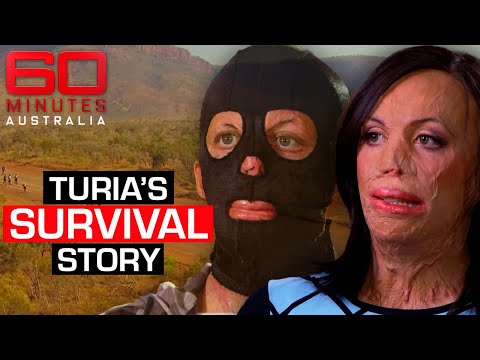 Turia Pitt's incredible survival story after horror bushfire | 60 Minutes Australia