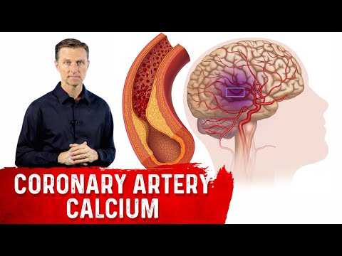 How to Read a Coronary Artery Calcium (CAC) Score
