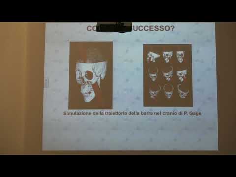 Dolore alla scapola sinistra dietro la schiena Atterraggio di aeromobili mal di collo