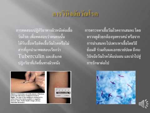 เพิ่มสมาชิก Magnitogorsk หญิงติดเชื้อลดลงราคา