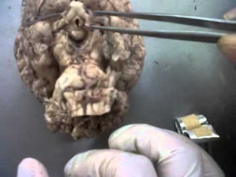 download lagu mp3 mp4 How Big Is A Horses Brain, download lagu How Big Is A Horses Brain gratis, unduh video klip How Big Is A Horses Brain