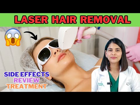 Laser Hair Removal: Review, Treatment, Side Effects ||...