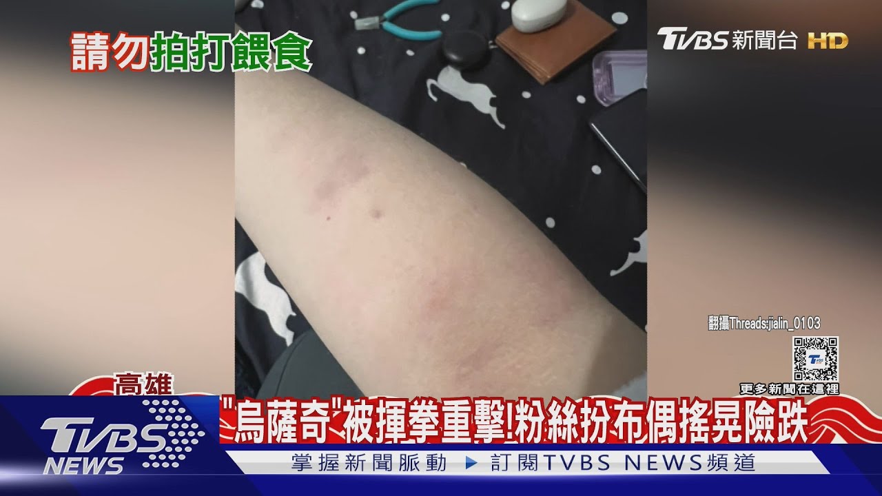 求求你別打了!「烏薩奇」遭揮拳狂毆 扮裝粉絲手瘀青