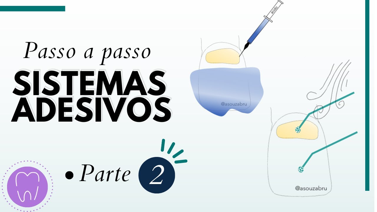 PASSO A PASSO SISTEMAS ADESIVOS - PARTE 2 - SOUZA BRU