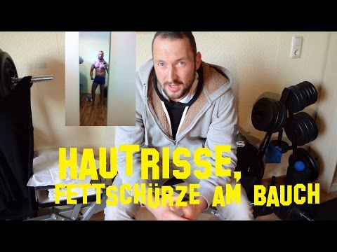 Gribok auf den Nägeln das Forum der Meister Die Gesundheit gribok auf den Fingern der Beine