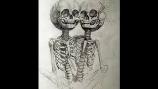 Fallout Boy:Twin Skeletons (Hotel In NYC) Lyrics