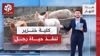 سابقة طبية.. رجل يعيش بكلية خنزير لأشهر قبل زراعة كلية بشرية | هذا النهار