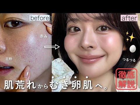 【🫧最強ホームケア2026🏠】速攻つるつる卵肌🥚✨誰でも美肌になれる､敏感肌向けスキンケア15選！♡