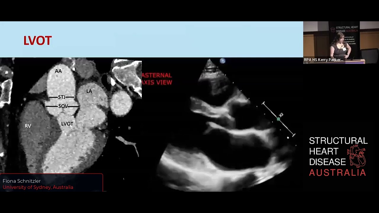 Anatomy of the Aortic valve - Dr Fiona Schnitzler