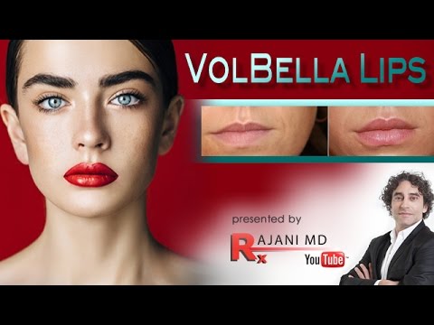 Volbella Lip Filler-Watch Dr Rajani