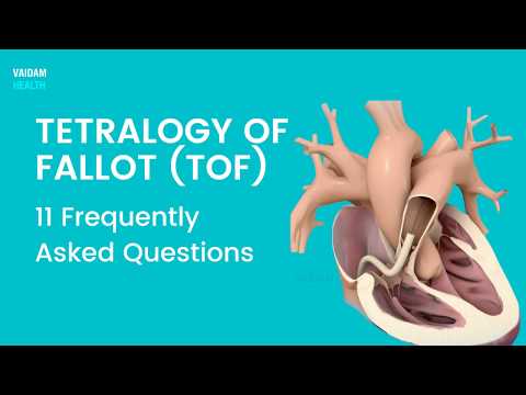 Tetralogy of Fallot- 11 Frequently Asked Questions.