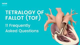Tetralogy of Fallot - 11 Frequently Asked Questions