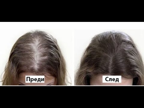 Превърнете тънката  #коса в гъста  за 30 дни с #Nescafe-двоен разтеж #HairLoss  #hairlosstreatment