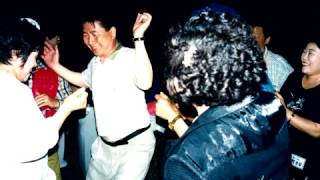 Cover art for 1억개의 응딩이`