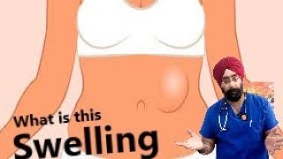 Most common cause of Abdominal Swelling Explained | LUMP in Abdomen | Dr.Education (Eng)