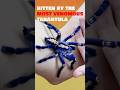 Bitten by the most venomous tarantula- the Gooty Sapphire 🕷️ #tarantula #venomous #spider