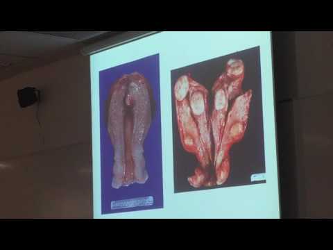 Laboratorio 10-Neoplasias benignas y malignas-Parte 1-Patología