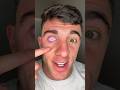 MY RINNEGAN EYEBALL