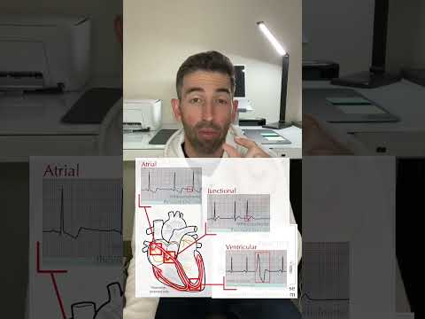 Rhythm recognition review: Accelerated idioventricular rhythm (AIVR)